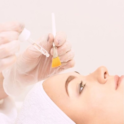 chemical peels at best skin clinic in Leicester