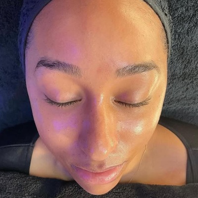 The best hydrafacials in Leicester The best hydrafacials in Leicester