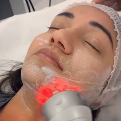 radiofrequency treatments - anti-ageing facials in Leicester radiofrequency treatments - anti-ageing facials in Leicester