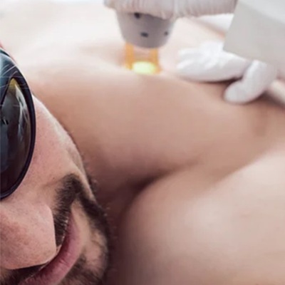 Laser hair removal at city laser and skin clinic leicester Laser hair removal at city laser and skin clinic leicester