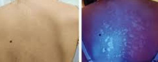 Consultations at City Laser & Skin Clinic Leicester