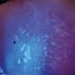 Why Do I Need A Skin Consultation?